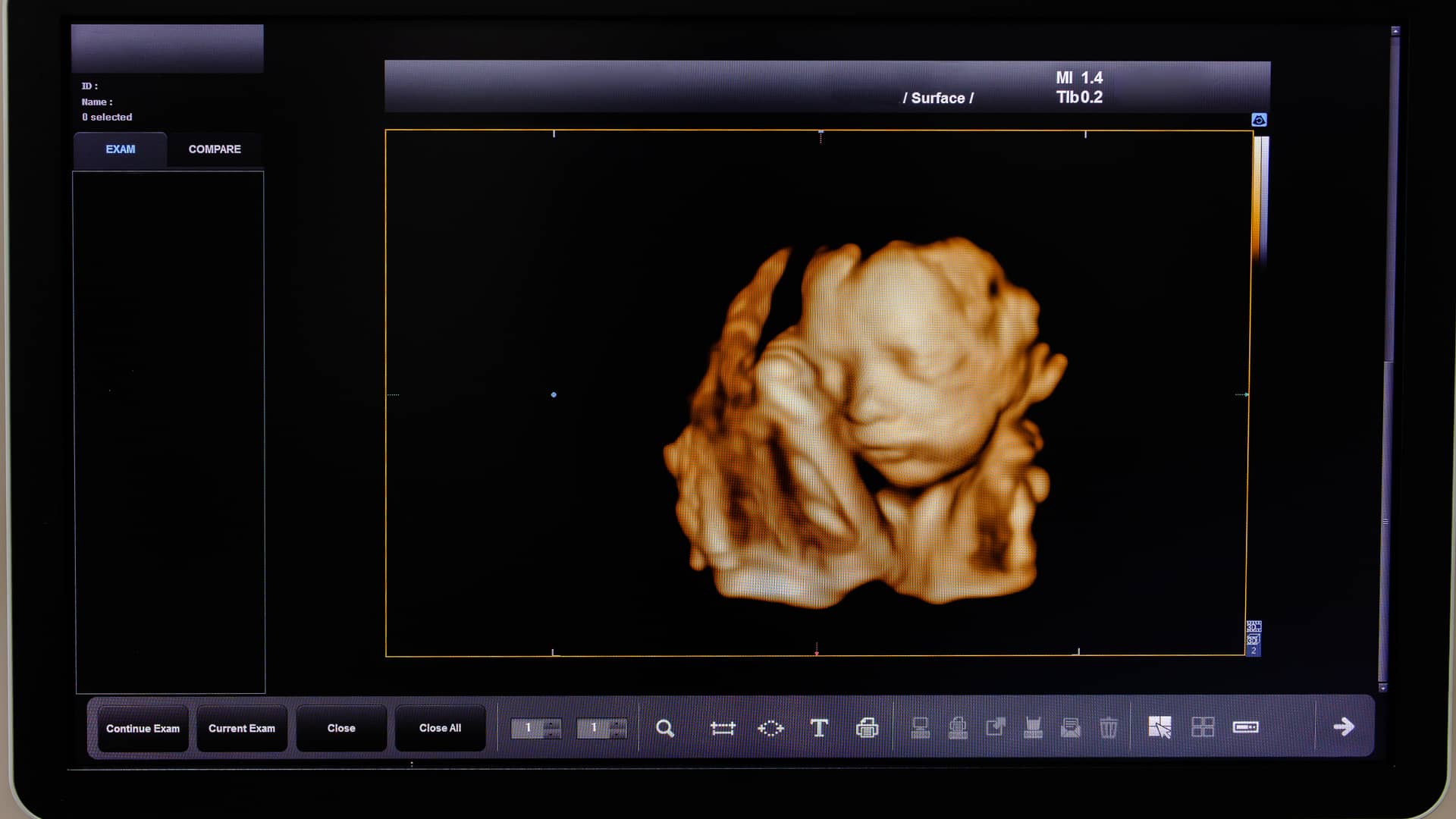Fotografía de una ecografía 4d de la semana 25 de embarazo