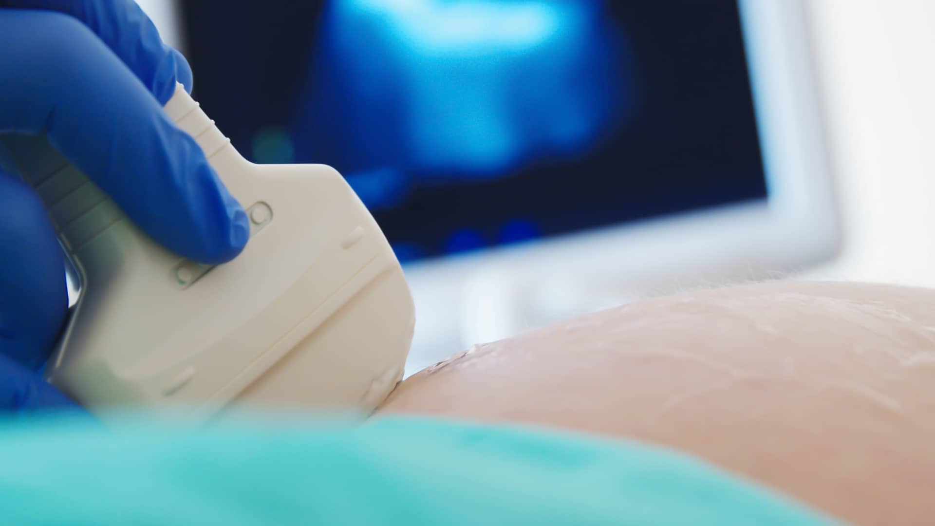 Médico realizando la última ecografía a una mujer de 34 semanas Médico realizando la última ecografía a una mujer de 34 semanas