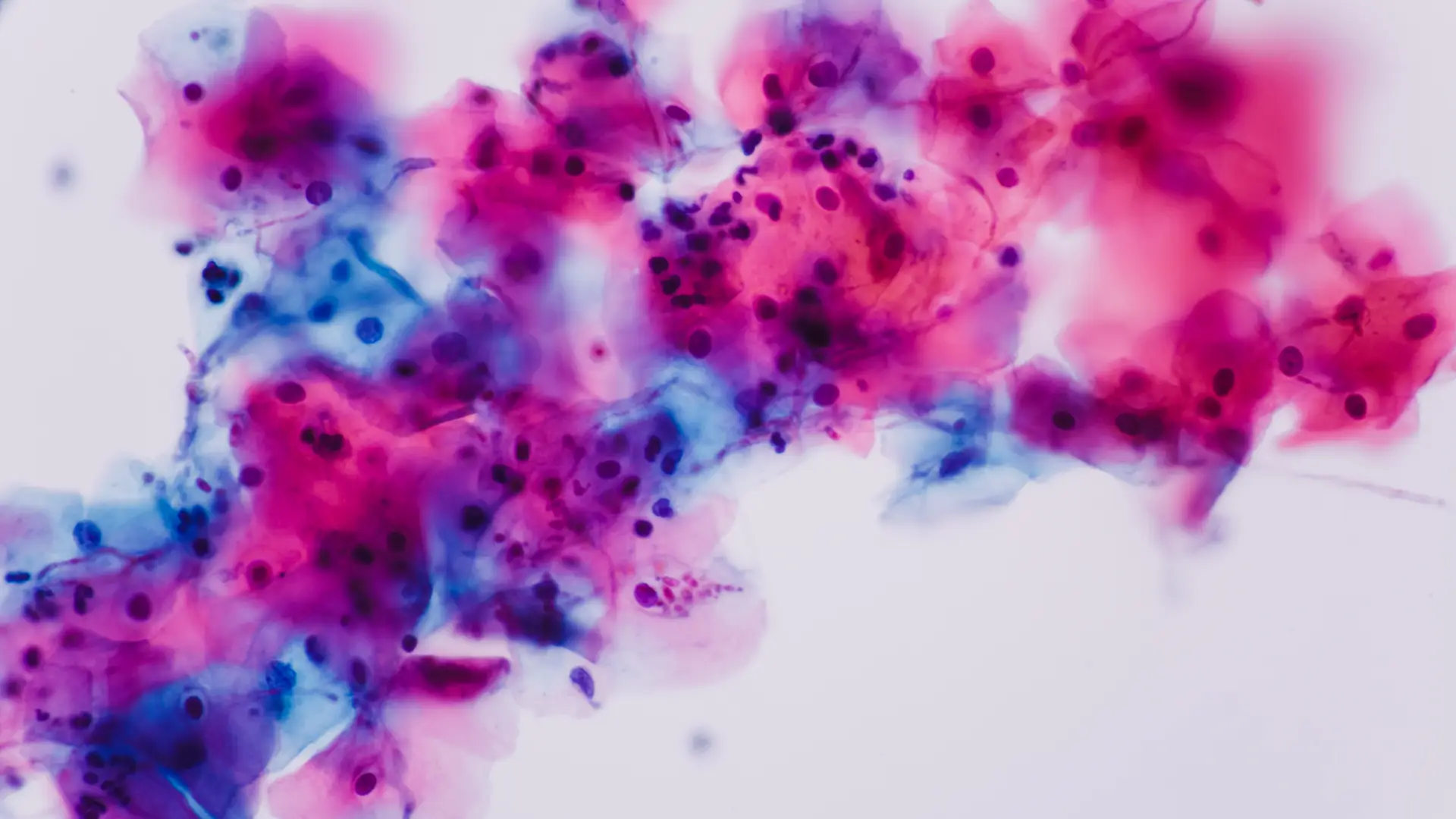 Imagen de la bacteria candida vista en el microscopio que produce candiasis que afecta a la infertilidad
