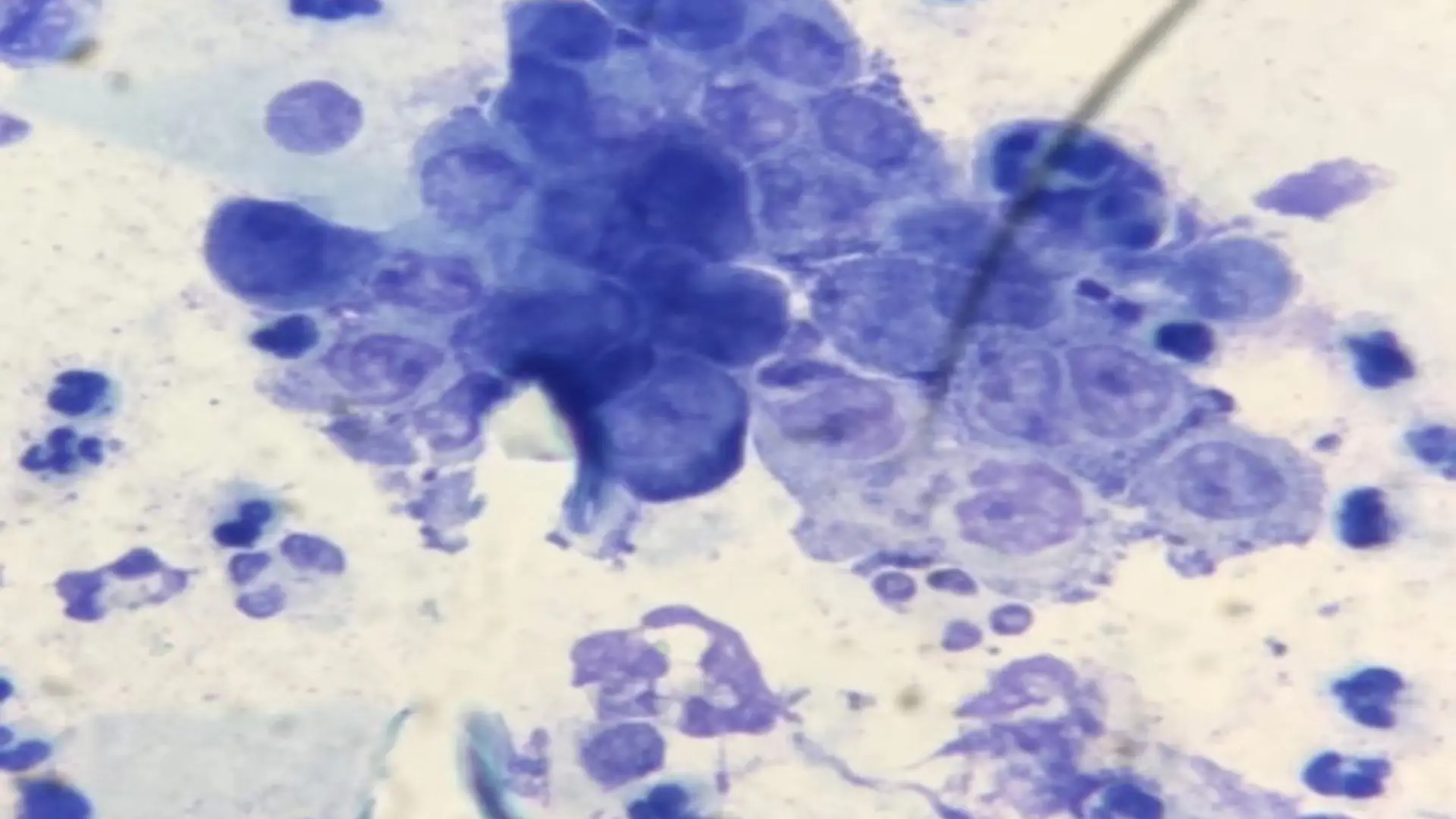 Clamidia vista desde el microscopio que puede producir infertilidad