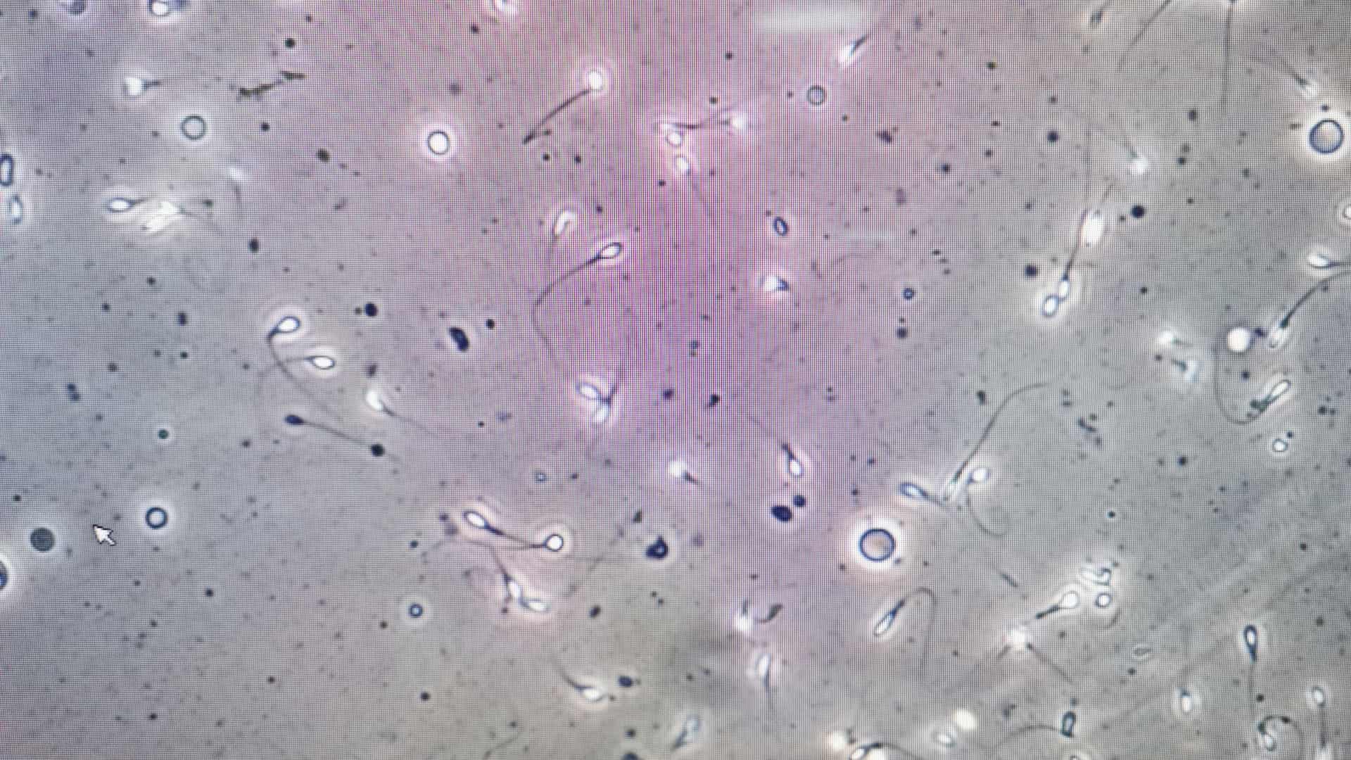Vista en el microscopio de una muestra de semen para rpresentar el lavado seminal que es una prueba de fertilidad masculina