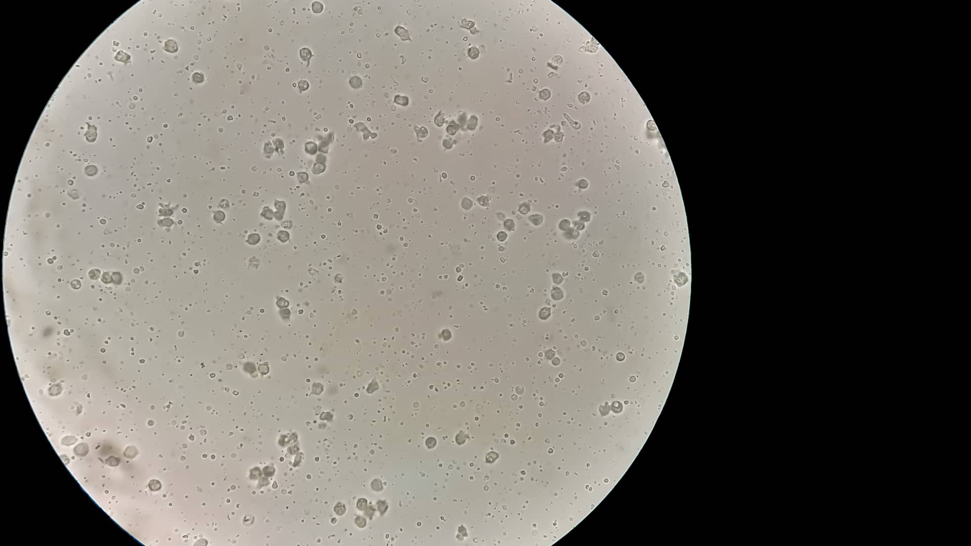 Vista en el microscopio de un seminograma que es una prubea de fertilidad masculina