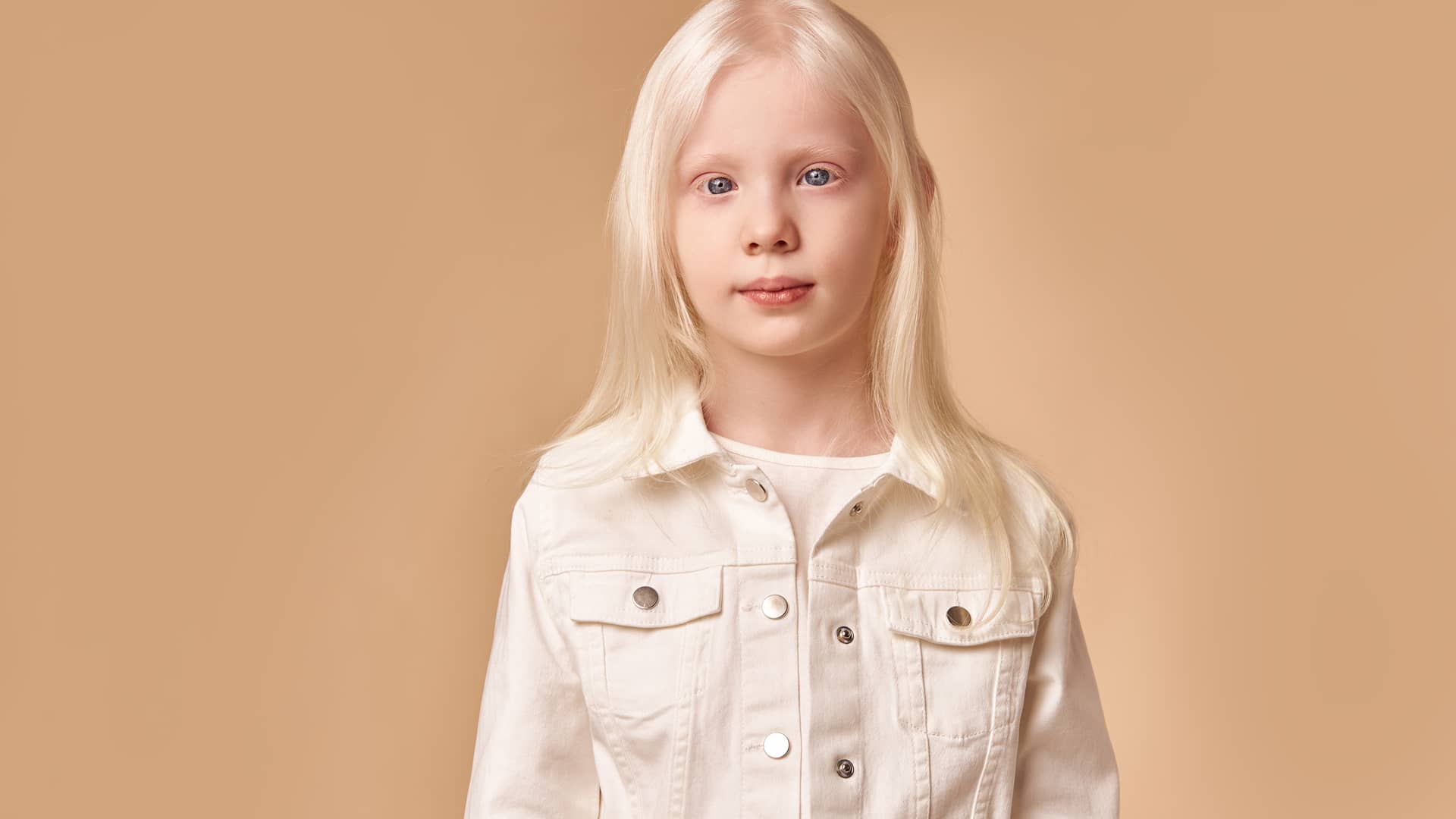niña muy rubia y palida que sufre una de las enfermedades raras mas comunes llamada albinismo niña muy rubia y palida que sufre una de las enfermedades raras mas comunes llamada albinismo