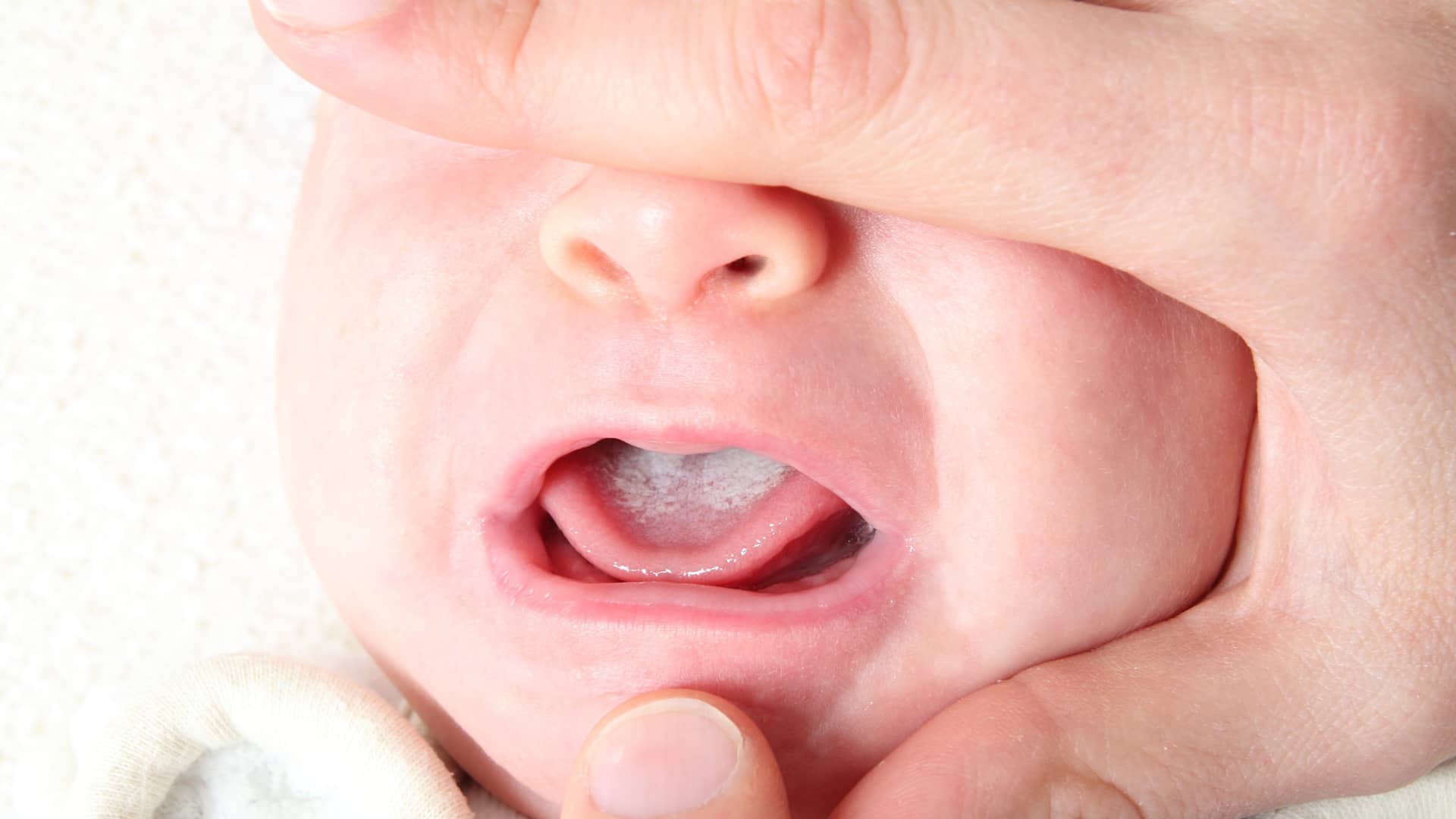 boca de un bebe con frenillo lingual boca de un bebe con frenillo lingual
