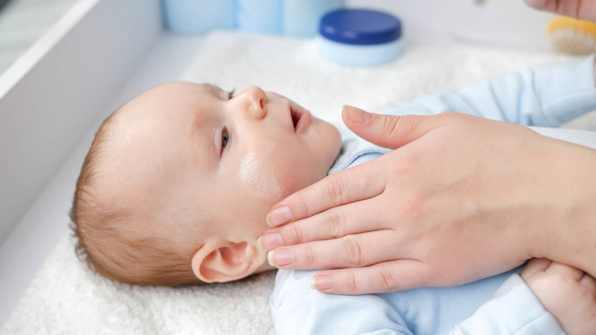 mama echandole cremita a la cara de su bebe para curar el sarpullido que tiene tipico en los niños mama echandole cremita a la cara de su bebe para curar el sarpullido que tiene tipico en los niños