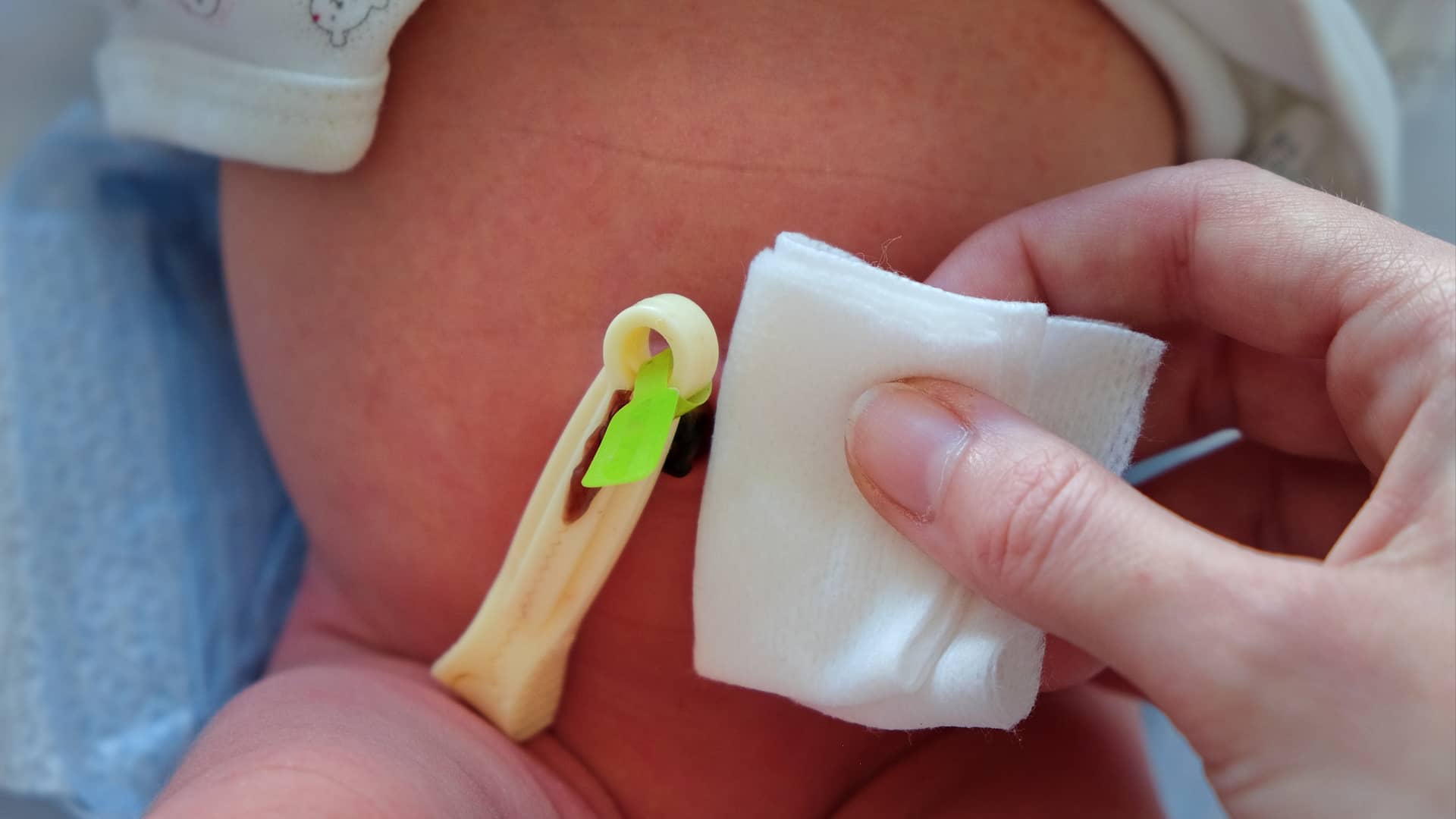 Barriga de un bebé con la pinza del cordón umbilical